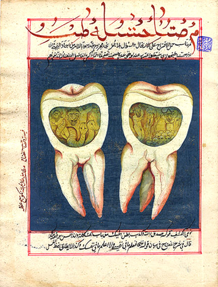 Иллюстрация с зубами, пораженными зубным червем. Османская рукопись 18 века: https://en.wikipedia.org/wiki/Tooth_worm#/media/File:Tooth_worm.jpg